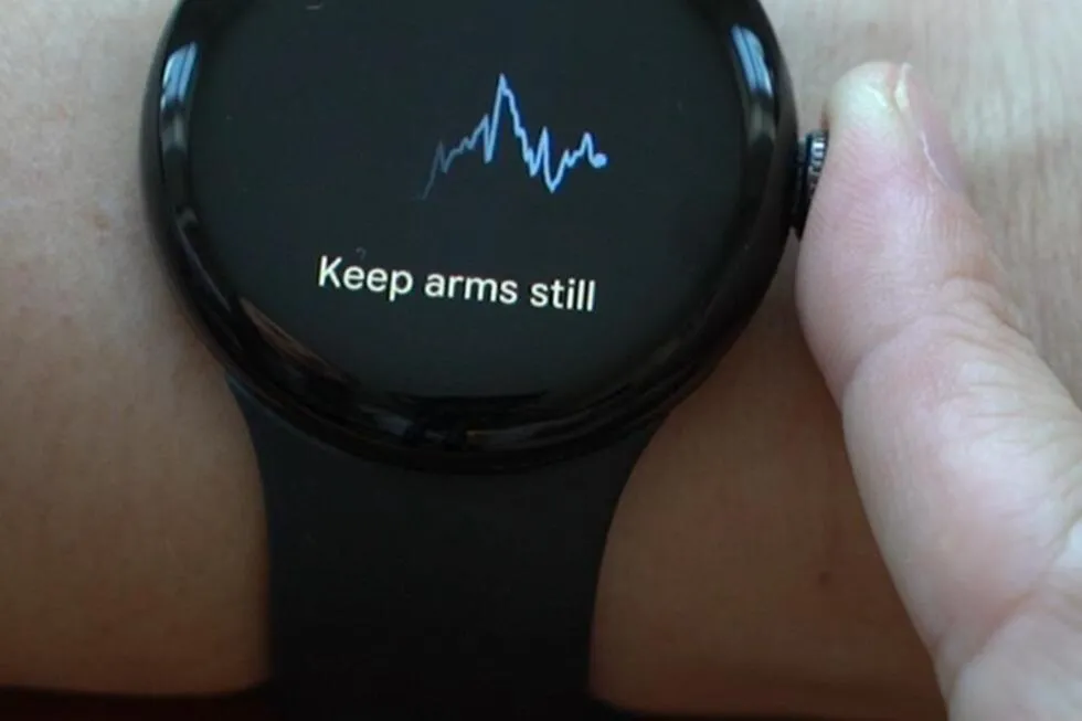 فیبریلاسیون دهلیزی چیست و چگونه درمان می شود؟